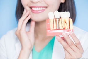 Key Considerations When Choosing an Implant Dentistry Course