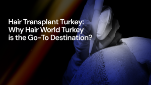 Hair Transplant Turkey: Why Hair World Turkey is the Go-To Destination?